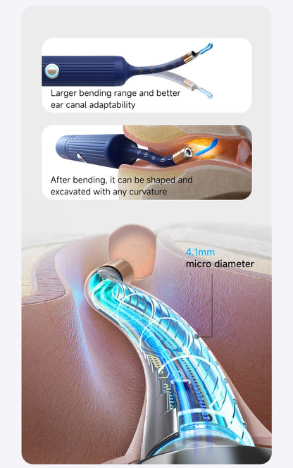 Bebird EarSight Plus R37R – Safe Visual Ear Cleaner with 10MP HD Camera for Elderly