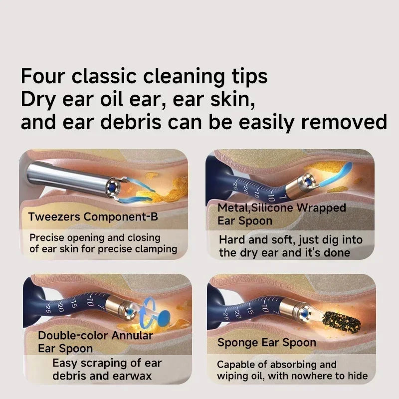 Bebird EarSight Plus R37R – Safe Visual Ear Cleaner with 10MP HD Camera for Elderly